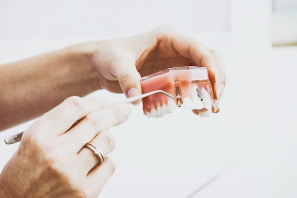 Are all-on-4 better than snap-in dentures
